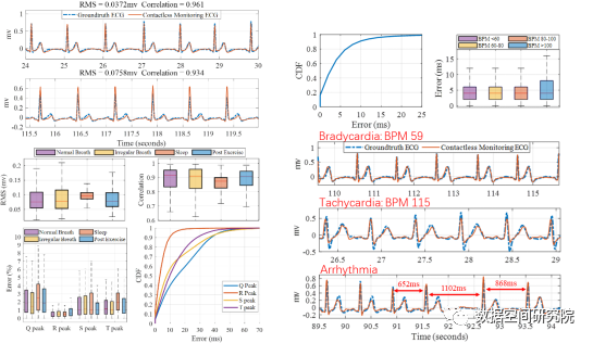 系统的时间和形态精度性能分析以及在不同心率状态下的监测结果对比